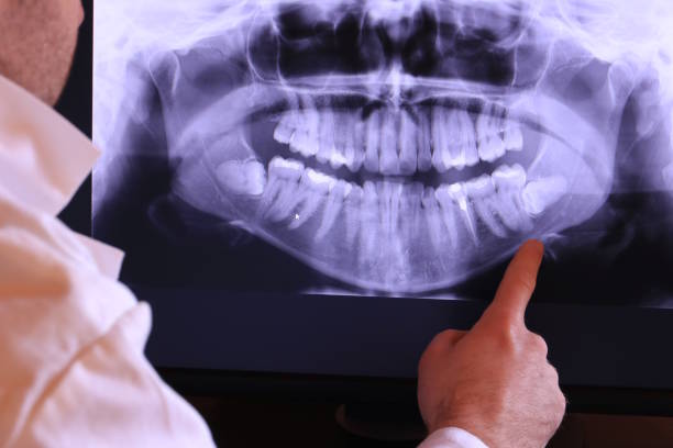 Best Emergency Root Canal Treatment in Newaygo, MI